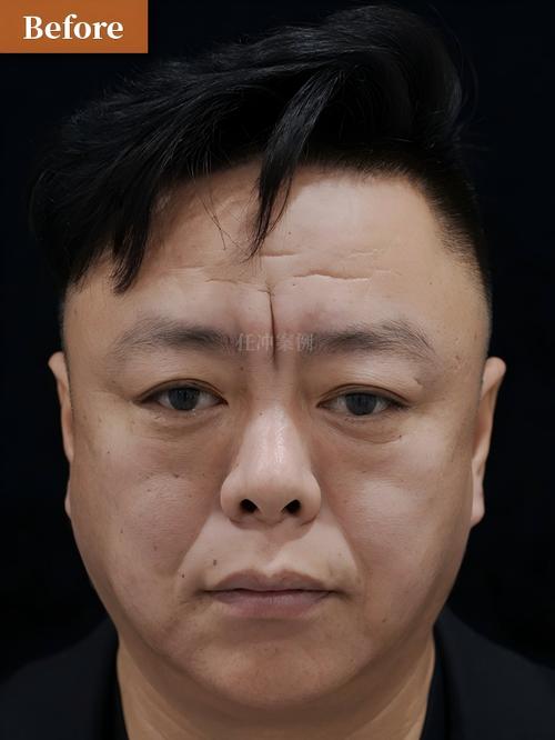 长安24小时在线套医保微信能用吗怎么弄？官方解答来了
